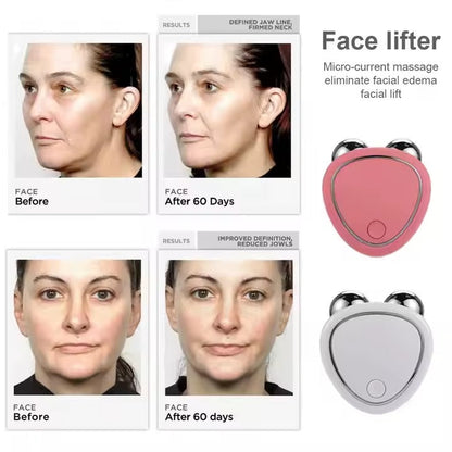 Masajeador Facial Microcorrientes